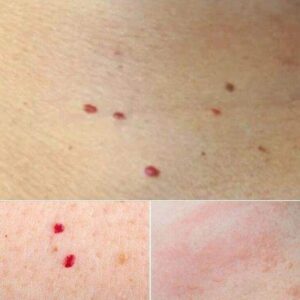 Red Dots On Your Skin: Causes And What They Might Represent – Newshot247