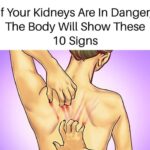 10 Warning Signs Your Kidneys May Be in Danger