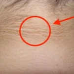 Dấu hiệu “lạ” trên cổ cảnh báo căn bệnh đáng sợ cha mẹ nên để ý ở con
