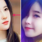 Bất kể nam hay nữ, có 4 nốt ruồi này là được lộc đất đai, hậu vận giàu sang nứt vách
