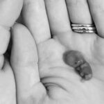 Mother shares photos of 9-week miscarried baby to show ‘God’s creativity and marvelousness’