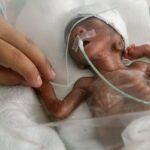 After Surviving Botched Abortion, 30-Week-Old Baby Suffered for Four Days Until He Died