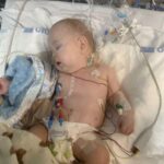 Seriously-ill baby has eight surgeries in as many months as parents say ‘we are not giving up’