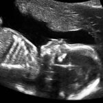 ‘Don’t you dare look at that!’ Women say abortion workers refused to let them see their ultrasound