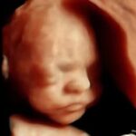 Scottish Government urged to reject extreme unrestricted abortion plan