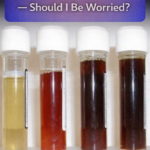 STR- My Dog’s Urine Is Very Dark — Should I Be Worried?