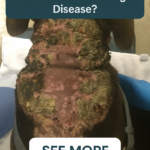STR- My Dog’s Skin Is Turning Darker — Is It Cushing’s Disease?