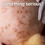 Weird Scabs Appearing on My Dog’s Back — What’s Causing Them and Should I Worry?