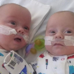 Twins Born at 23 Weeks Were Given Just 1% Chance to Survive, But They Defied the Odds