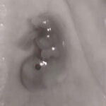 The midwife thought my miscarried baby was just ’tissue’… then she saw the photo and cried.