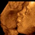 Trump Admin Ending $22 Million in Research With Aborted Baby Parts