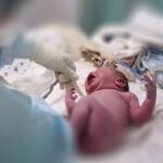 Doctors deliver baby prematurely after mother is injured in drone attack