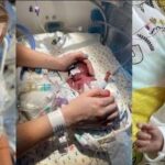 Baby born at 23 weeks heads home with her family: ‘It’s a miracle that she survived’