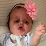 Cruel Pro-Abortion Trolls Call This Disabled Baby a “Monster”