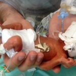 World’s Most Premature Baby Ever, Born at 21 Weeks, Celebrates His 4th Birthday