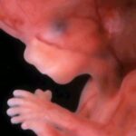 One couple’s heartbreaking tale of miscarriage gives contrast to abortion
