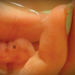 Mom posts amazing photos of her babies, miscarried at 7 and 8 weeks, on Facebook