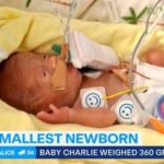 Queensland’s smallest baby born weighing just 360 grams