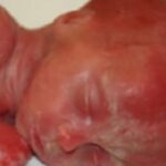 This Baby Was Born Alive After an Abortion and Then Left to Die
