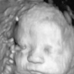 Pennsylvania House Passes Amendment for Abortions Up to Birth