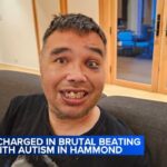 ST. Suspect charged in brutal beating of man with autism at Hammond park: police