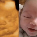 Scientist Confirms: An Unborn Baby is a Human Being From the Moment of Conception