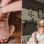 Beautiful family photos feature baby who had prenatal spina bifida surgery