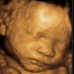 Indiana Abortions Drop From 1,979 to 26 as Abortion Ban Saves Babies
