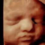 UK Peers snub commonsense amendments, decriminalize self-managed abortion to birth