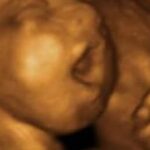 Wyoming Becomes 19th State to Protect Babies From Abortions
