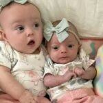 Premature Baby Born 11 Weeks Early Survives Even Though She Weighed Less Than Half of Her Twin