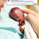 Miscarried at 19 weeks, baby Walter’s life is changing the abortion debate