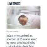 Infant who survived an abortion at 35 weeks saved by nurse who heard baby crying inside plastic bag