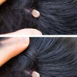 A Mysterious Lump in a Child’s Hair Sparks Concern and Questions