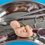 ‘DEFUND 250’: Taxpayer-funded Planned Parenthood helps to create more abortionists