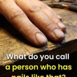 Think Twice Before Judging — What Dirty Nails Could Actually Reveal