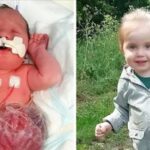 ‘A true inspiration’: Parents choose life for baby girl born with organs outside her body