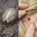 Found a Weird Bug in Your Child’s Hair? Important Info for Parents