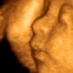 New Report Shows 1.1 Million Babies Killed in Abortions Last Year