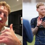 Ben Stokes reveals he is ‘lucky’ to be alive after horror cricket injury left England captain’s face a ‘mess’ and requiring major surgery: ‘Thankfully I’m still here’