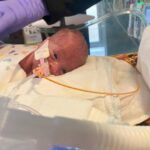 ‘The doctors had tried everything’: Preemie born at 22 weeks called ‘miracle’