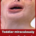 Toddler gets 90 percent burns and survives house blaze against all odds – this is her today