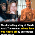 The sad story of Charla Nash, the woman whose face was ripped off by an chimpanzee