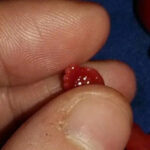 Miscarried at 14 weeks, baby Phoenix shares the humanity of preborn children