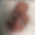 Pro-life advocates hold rally after baby left to die following failed abortion