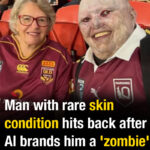 Man with rare skin condition hits back after AI brands him a ‘zombie’ in viral photo