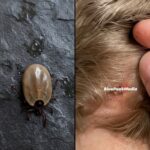 The Horrible Finding in My Child’s Hair That Prevented Her Death: The Unknown Medical Disaster Every Parent Should Be Aware of